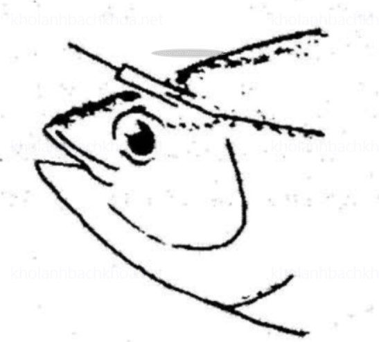 Xuyên que thăm vào tuỷ sống