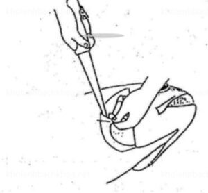 Cắt bỏ các lớp màng nằm trên vành mang cá