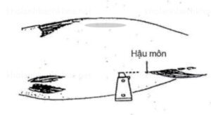 Chèn một con dao 8cm phía trước hậu môn, sau đó cắt theo hướng thẳng 